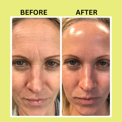 Retinal Shot Tightening Serum